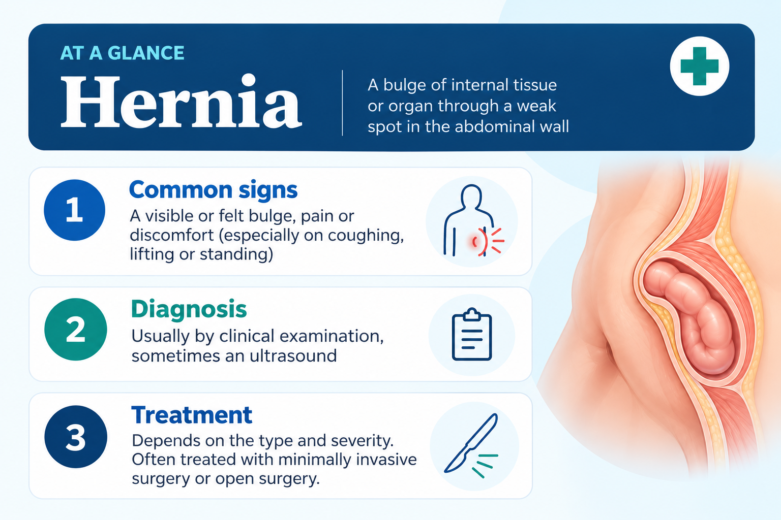 Hernia infographic