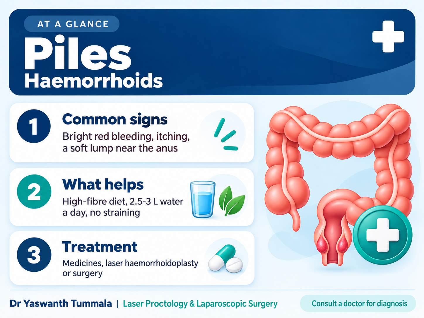 Piles (Haemorrhoids) infographic